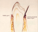 牙周病第O 階段：健康牙齒